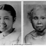 breakthrough-advances-bring-new-hope-to-werner-syndrome-patients