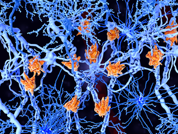 multiple-sclerosis-society-announces-ms-research-and-funding-opportunities