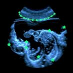 real-time-ultrasound-holography-via-thermographic-imaging