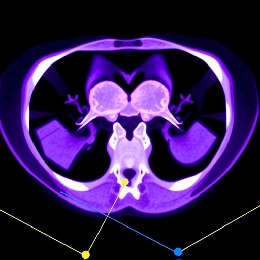 deep-learning-enhances-pet/ct-analysis-in-endometrial-cancer
