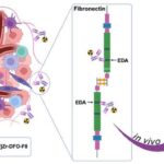 innovative-imaging-technique-identifies-multiple-subtypes-of-triple-negative-breast-cancer