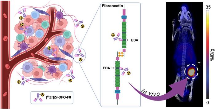 innovative-imaging-technique-identifies-multiple-subtypes-of-triple-negative-breast-cancer
