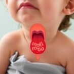 new-study-connects-skin-barrier-dysfunction-to-pediatric-eosinophilic-esophagitis