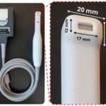 ultrasound-toothbrush-enables-advanced-gum-health-monitoring