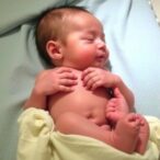 key-factors-influencing-cord-clamping-in-preterm-neonates