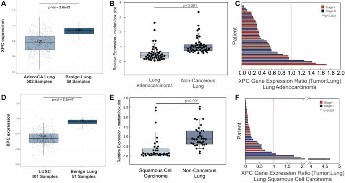 how-cigarette-smoke-and-dna-repair-deficiency-collaborate-to-drive-lung-cancer-development