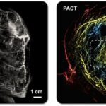 ai-powered-method-provides-safe,-effective,-and-painless-alternative-for-breast-imaging