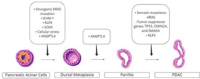 ai-models-may-detect-early-stage-pancreatic-cancer-and-predict-disease-prognosis
