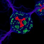 small-molecule-tkis-boost-her2+-breast-cancer-therapy