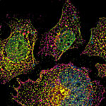 enhancing-asos-efficacy-by-slowing-down-intracellular-transport