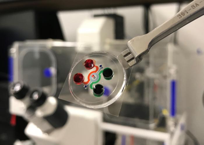 ‘leukemia-on-a-chip’-innovation-set-to-revolutionize-car-t-cell-therapy-for-blood-cancer