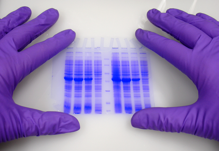 licorbio-acquires-serva-electrophoresis