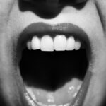 secrets-of-rapid-scarless-mouth-healing-uncovered-via-scrna-seq