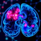 scientists-identify-protein-driving-lung-cancer’s-spread-to-the-brain