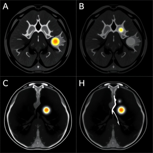 tumor-to-parenchyma-pet-ratio-predicts-chemotherapy-response