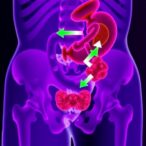 plasma-mir-9,-mir-106a-linked-to-peritoneal-carcinomatosis