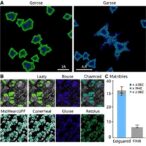 glucose-metabolism-controls-cd4+-t-cell-fate