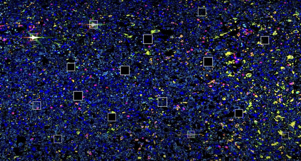 spatial-biology-adds-sorting-via-slacs-technology