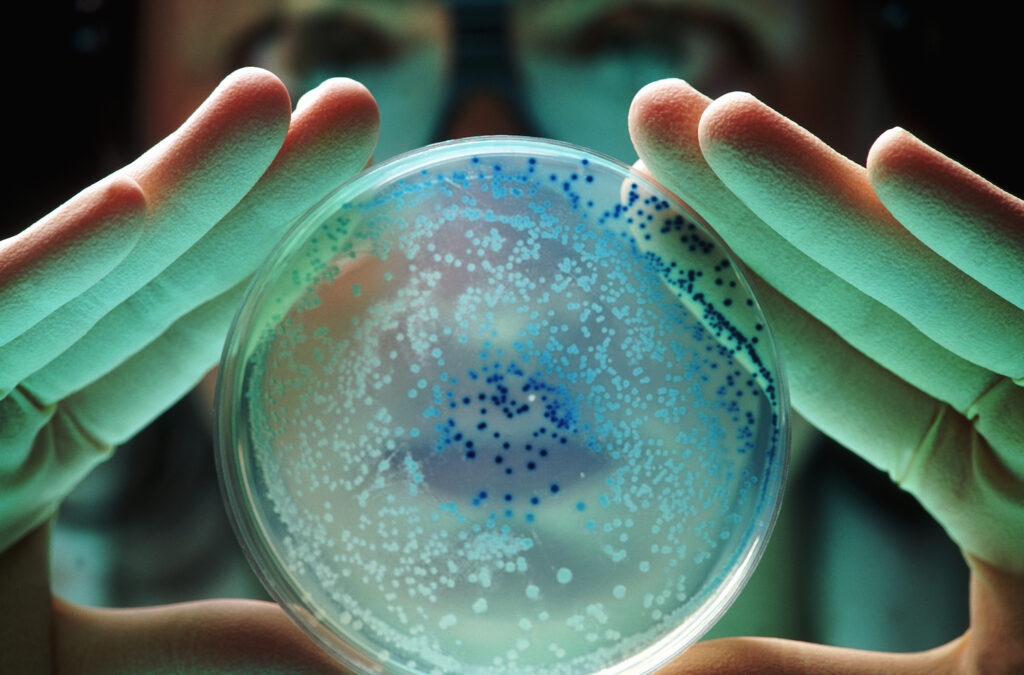 ai-designed-protein-disarms-membrane-transporter-to-defeat-resistant-bacteria