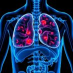 imidazole-propionate:-key-driver-and-target-in-atherosclerosis