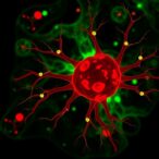 neutrophils-trigger-vascular-blockage-and-metastasis