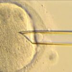 mitochondrial-disease-milestone:-eight-babies-born-free-of-disease-via-pronuclear-transfer