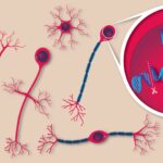 prime-editing-reverses-childhood-brain-disorder-in-mouse-model