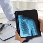 orthopedic-implant-maker-shoulder-innovations-sets-terms-for-$100m+-ipo