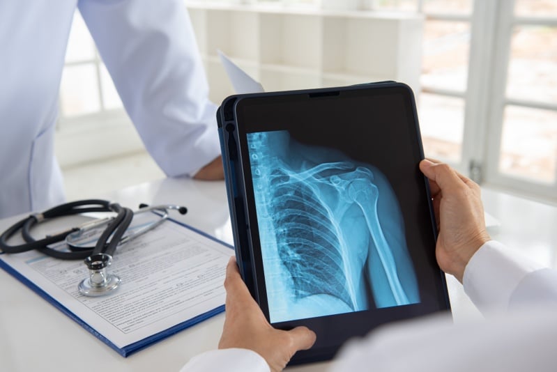 orthopedic-implant-maker-shoulder-innovations-sets-terms-for-$100m+-ipo