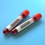roche-nets-european-approval-for-blood-test-to-rule-out-alzheimer’s-disease