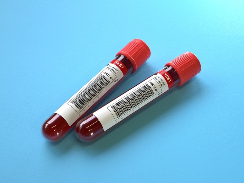 roche-nets-european-approval-for-blood-test-to-rule-out-alzheimer’s-disease
