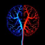 glymphatic-asymmetry-linked-to-parkinson’s-onset-side