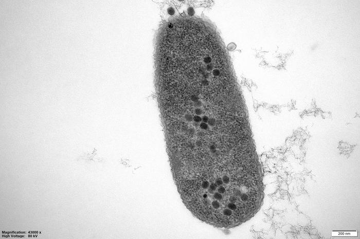 antimicrobial-resistance-strategies-may-be-informed-by-bacteria’s-kiwa-phage-defense-system