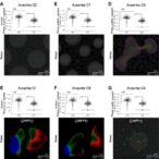 p16-positive-senescent-cells-drive-dkd-via-metabolic-dysfunction