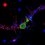 autocrine-interferon-triggers-adar1-synthetic-lethality-in-brca-mutants