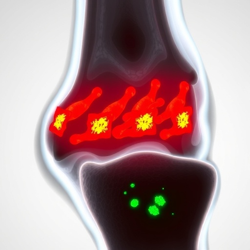 cd142+-synovial-fibroblasts-fuel-meniscus-damage-in-ra