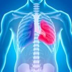 not-all-low-grade-prostate-cancers-pose-low-risk,-study-finds