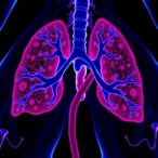 decoding-the-mechanisms-behind-chemotherapy-resistance-in-bladder-cancer
