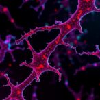 cancer-associated-fibroblasts:-drivers-of-drug-resistance