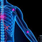 ccl2-ccr2-axis-triggers-als-neuromuscular-denervation