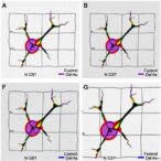 circrnas-drive-neural-crest-migration-in-hirschsprung’s-disease
