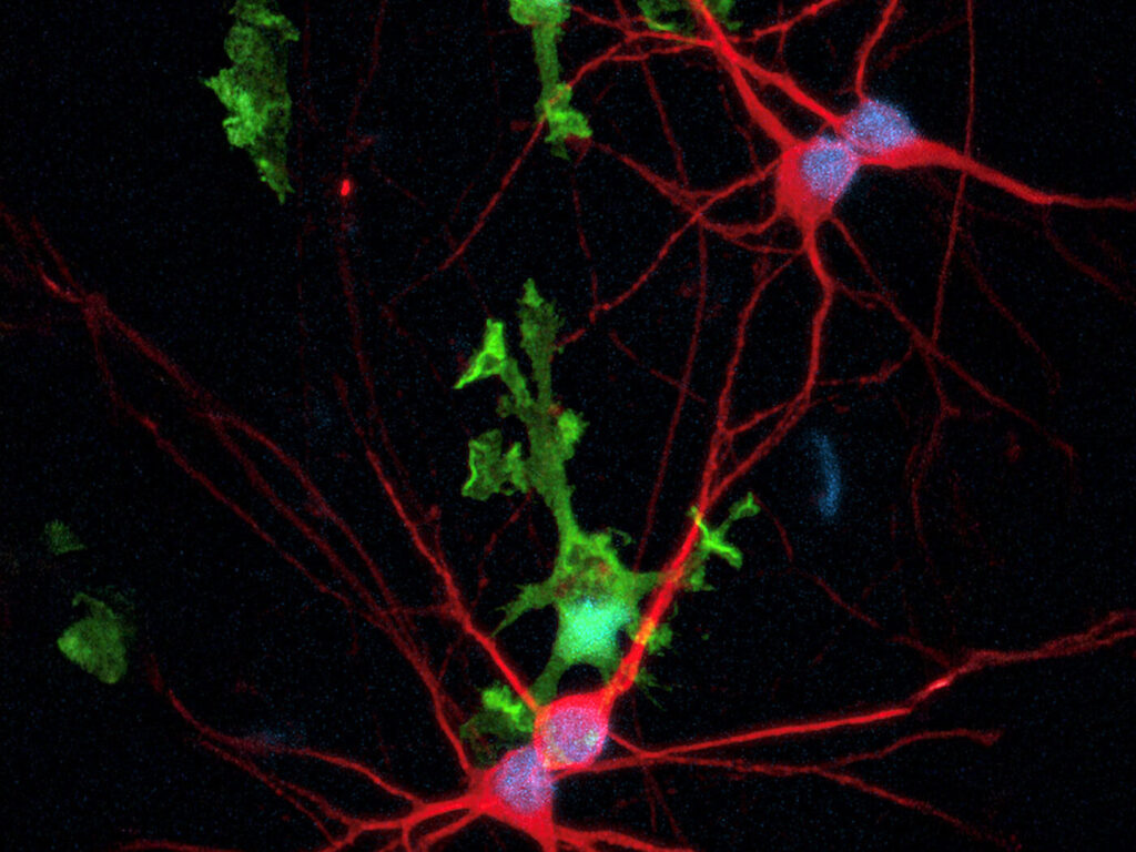 designer-stem-cells-power-new-r&d-assay-systems