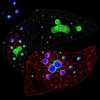 hadha-controls-jak/stat3-in-glioblastoma-via-metabolism