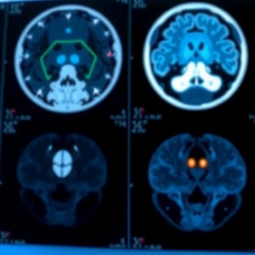 revolutionary-ai-tool-requires-minimal-data-to-analyze-medical-images
