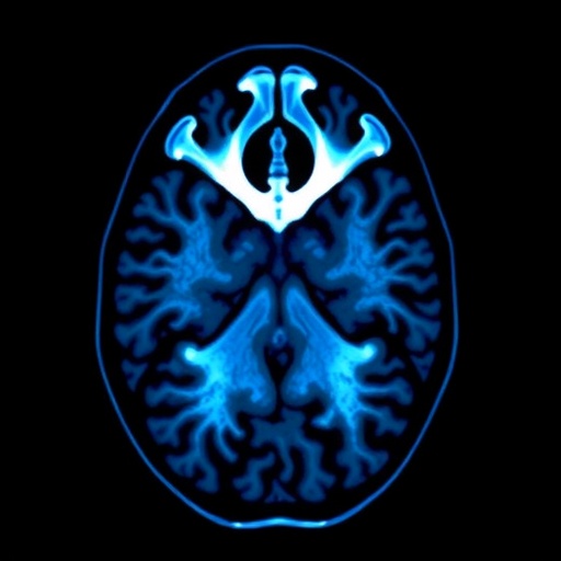 deep-learning-advances-mri-diagnosis-of-brucella