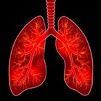 predicting-lung-infections-after-brain-hemorrhage
