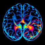 impact-of-morphology-and-location-on-aneurysms