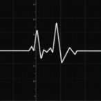 hybrid-approach-detects-ballistocardiogram-motion-artifacts