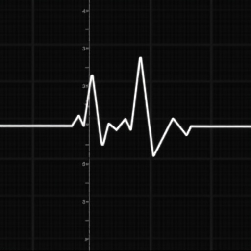 hybrid-approach-detects-ballistocardiogram-motion-artifacts