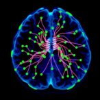 csf-ctdna:-new-biomarker-for-nsclc-brain-mets